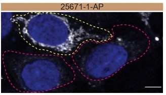 IF Staining of HAP1 using 25671-1-AP