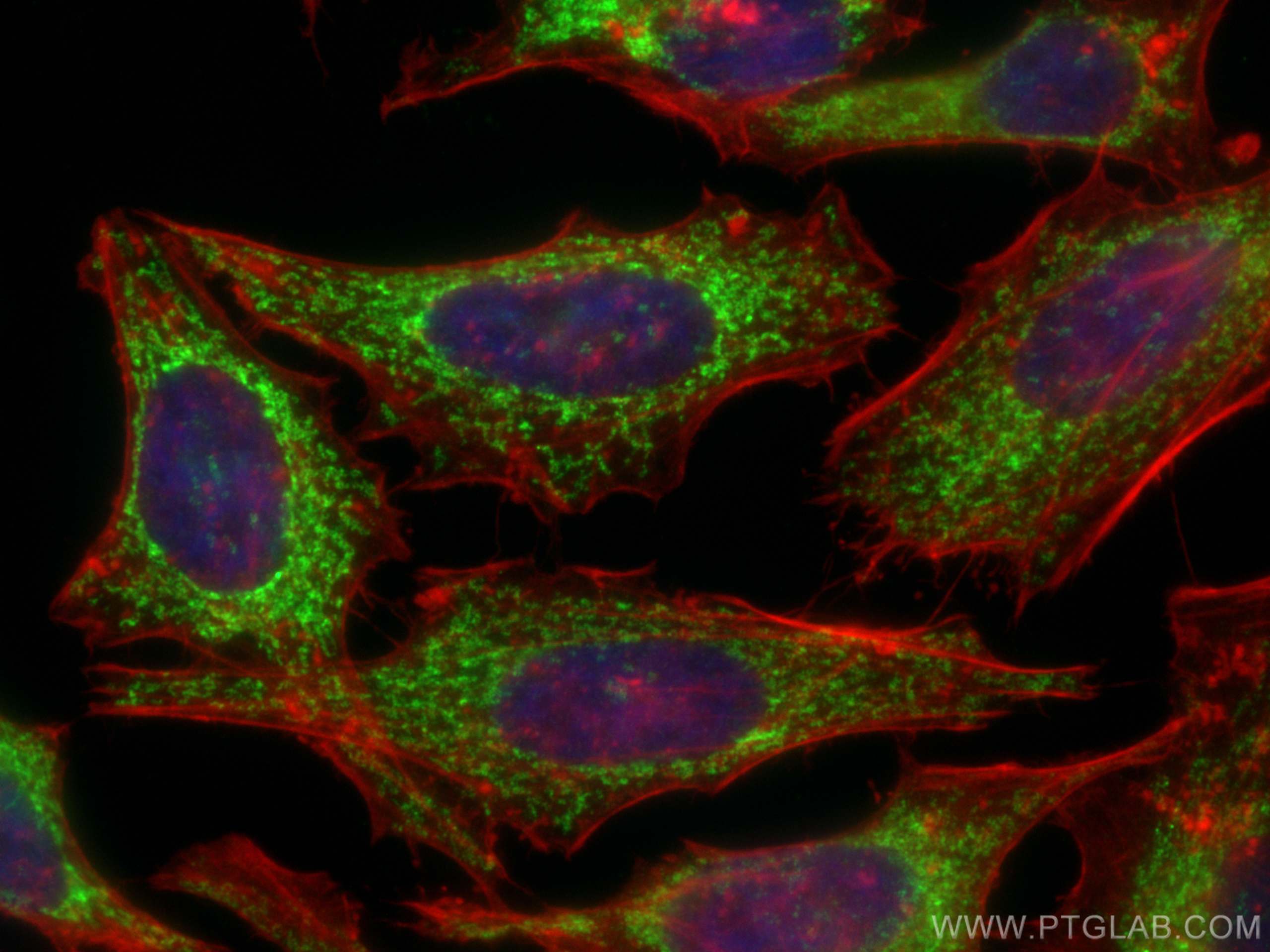 IF Staining of HeLa using 25671-1-AP