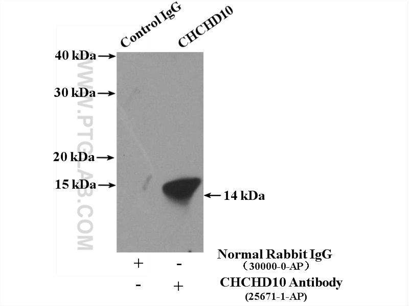 IP experiment of mouse heart using 25671-1-AP