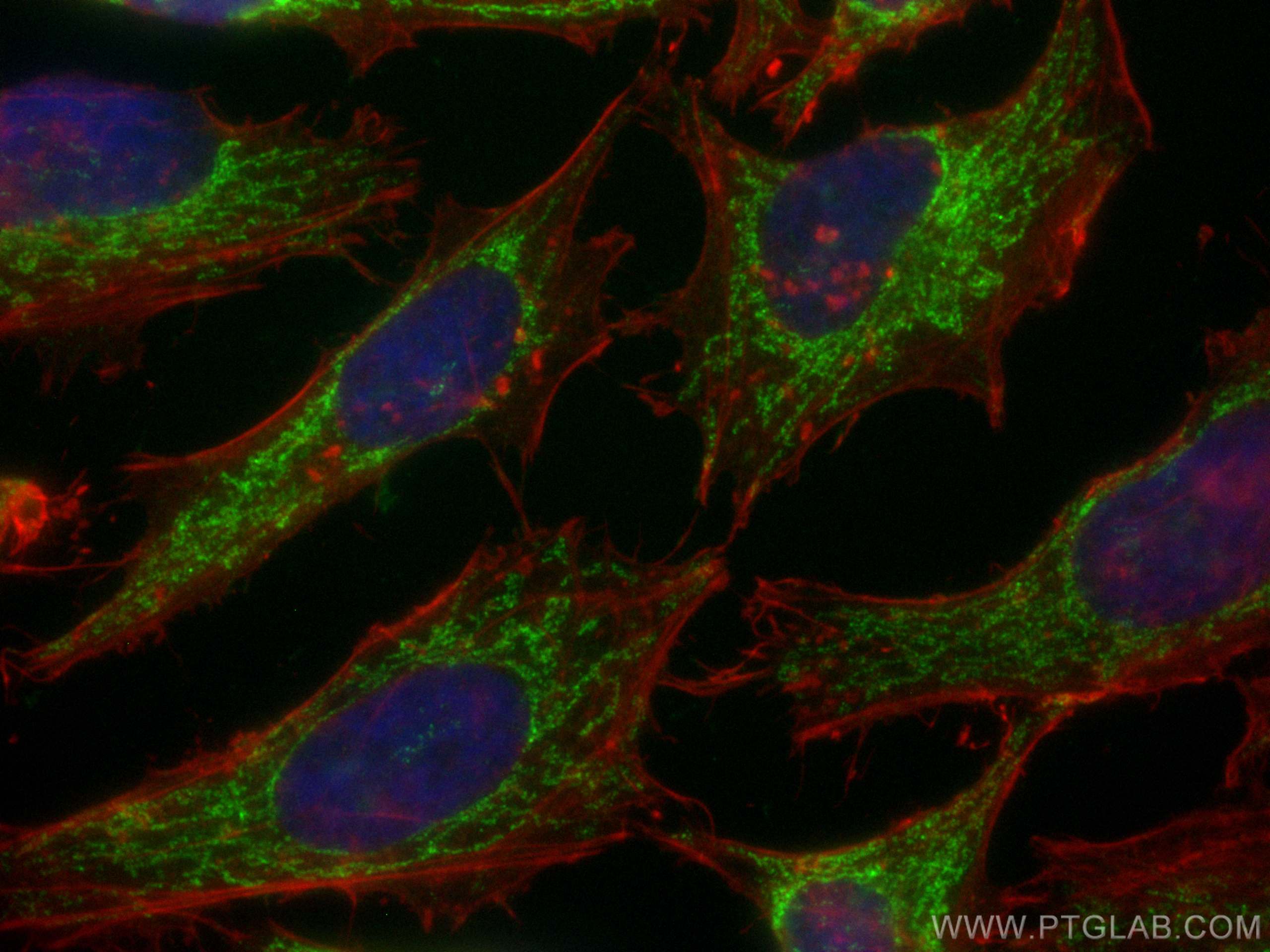 IF Staining of HeLa using CL488-25671