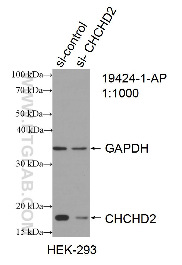 WB analysis of HEK-293 using 19424-1-AP