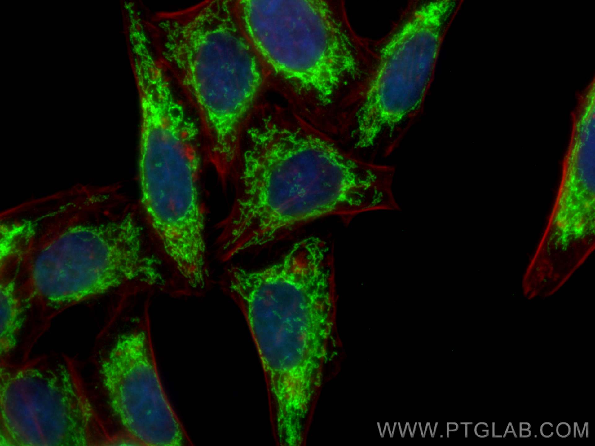 IF Staining of HepG2 using 66302-1-Ig