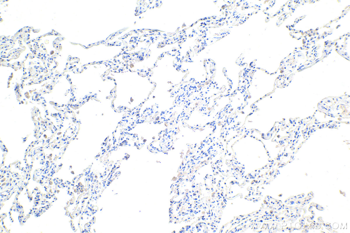 IHC staining of human lung using 68259-1-Ig (same clone as 68259-1-PBS)