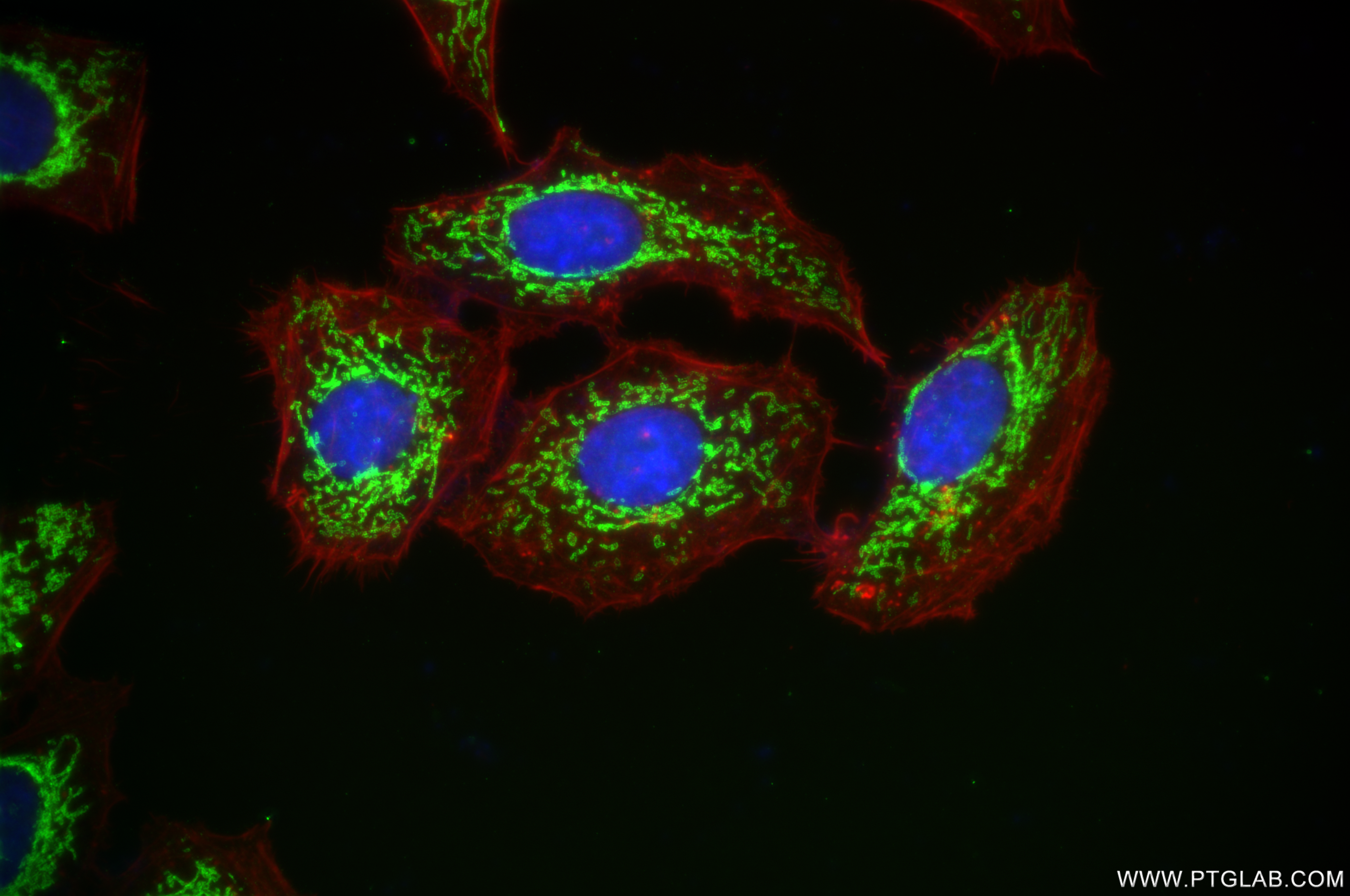 IF Staining of HepG2 using 82743-1-RR (same clone as 82743-1-PBS)