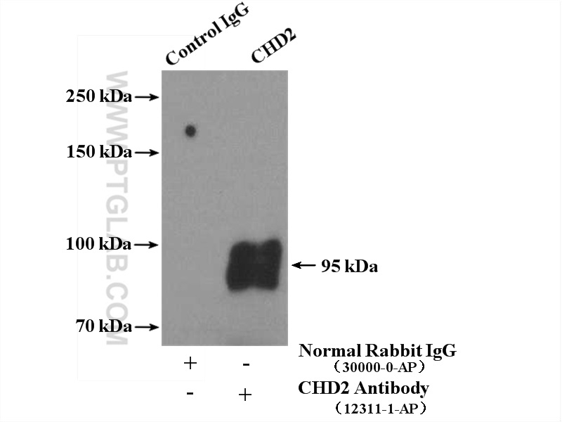 IP experiment of human placenta using 12311-1-AP