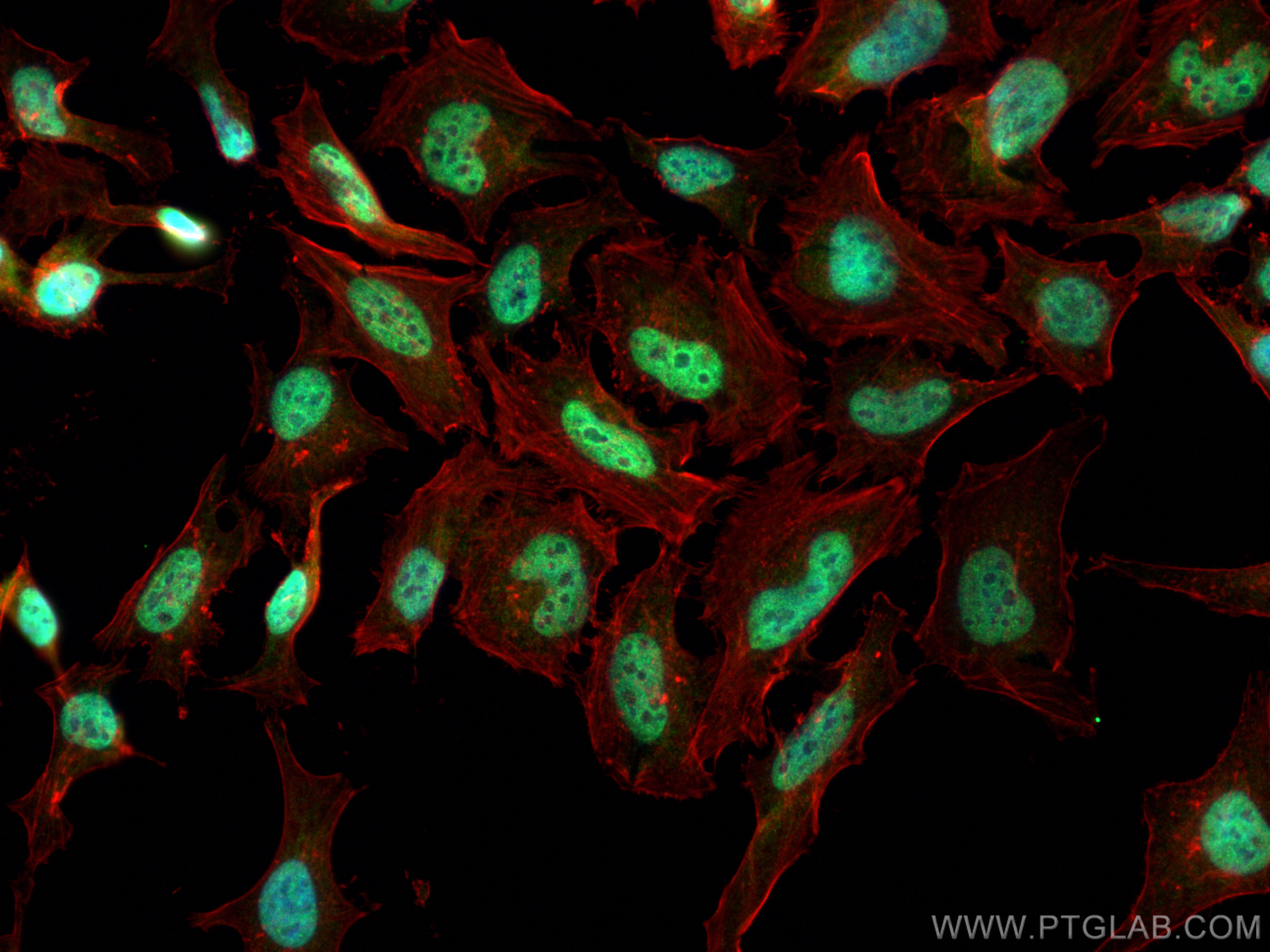 IF Staining of HeLa using 21334-1-AP