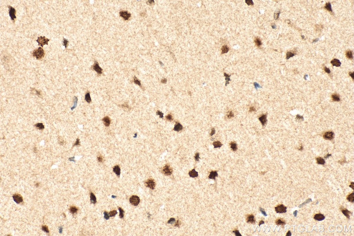 IHC staining of rat brain using 21334-1-AP