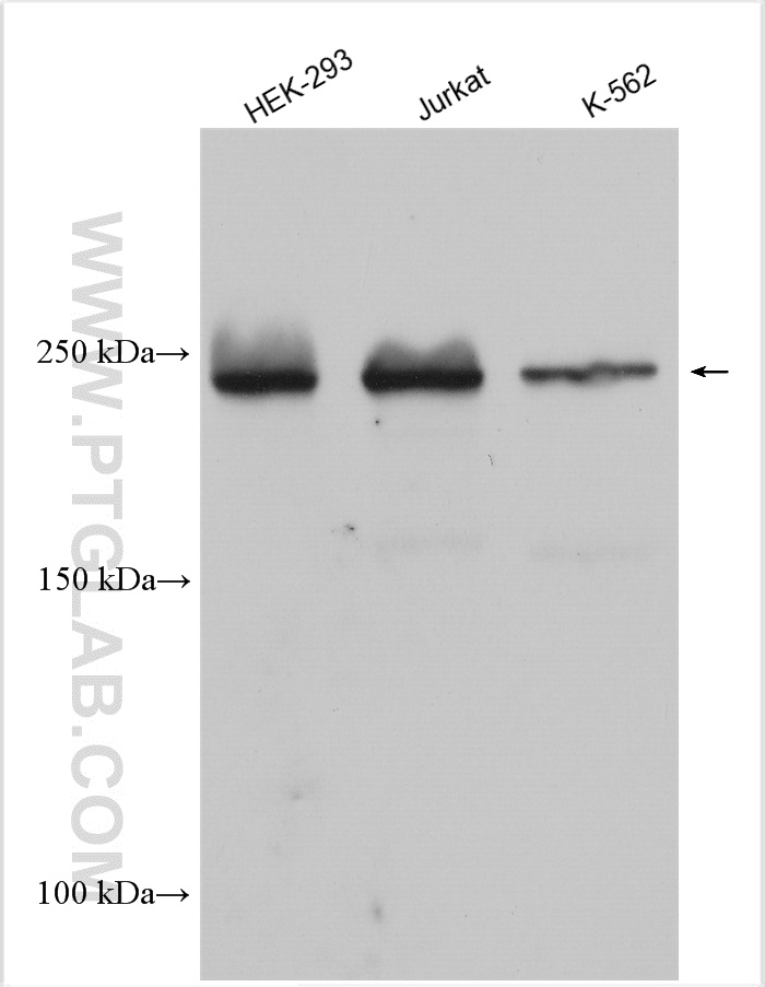 WB analysis using 21334-1-AP