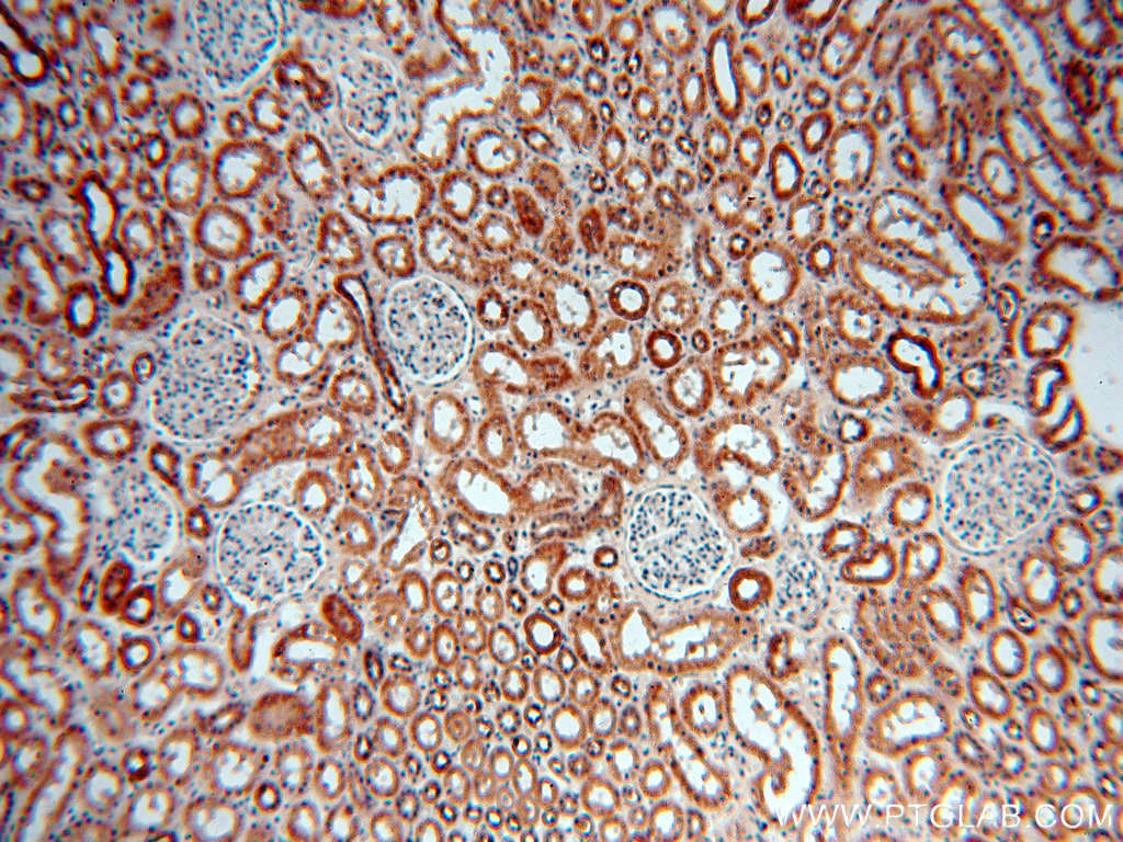 IHC staining of human kidney using 13402-1-AP