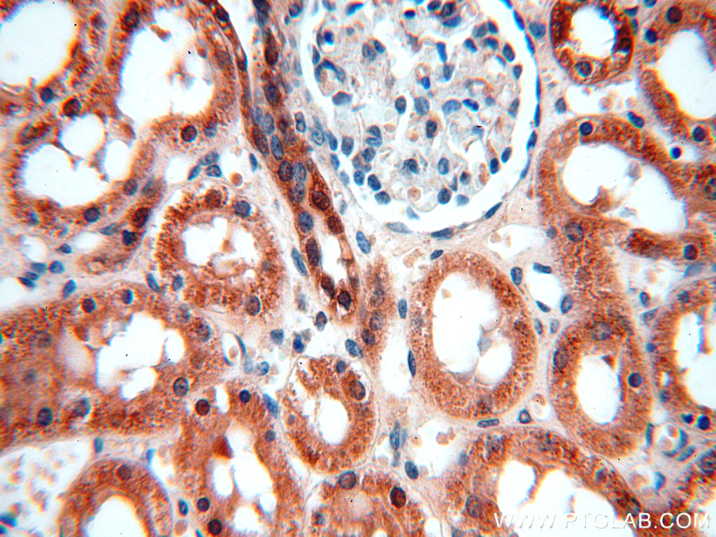 IHC staining of human kidney using 13402-1-AP