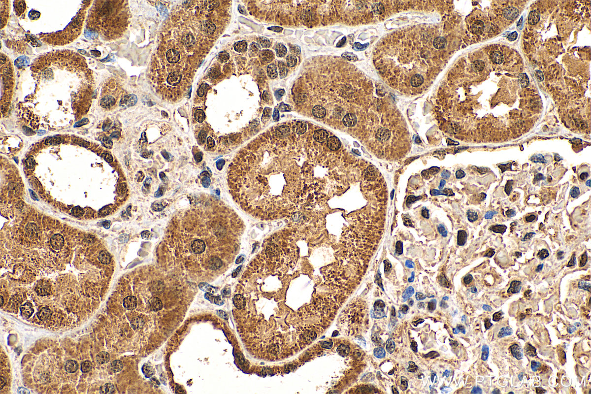 IHC staining of human kidney using 25389-1-AP