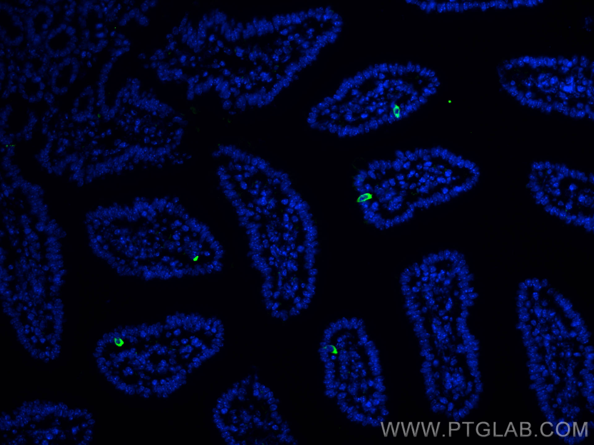 IF Staining of mouse small intestine using 10529-1-AP