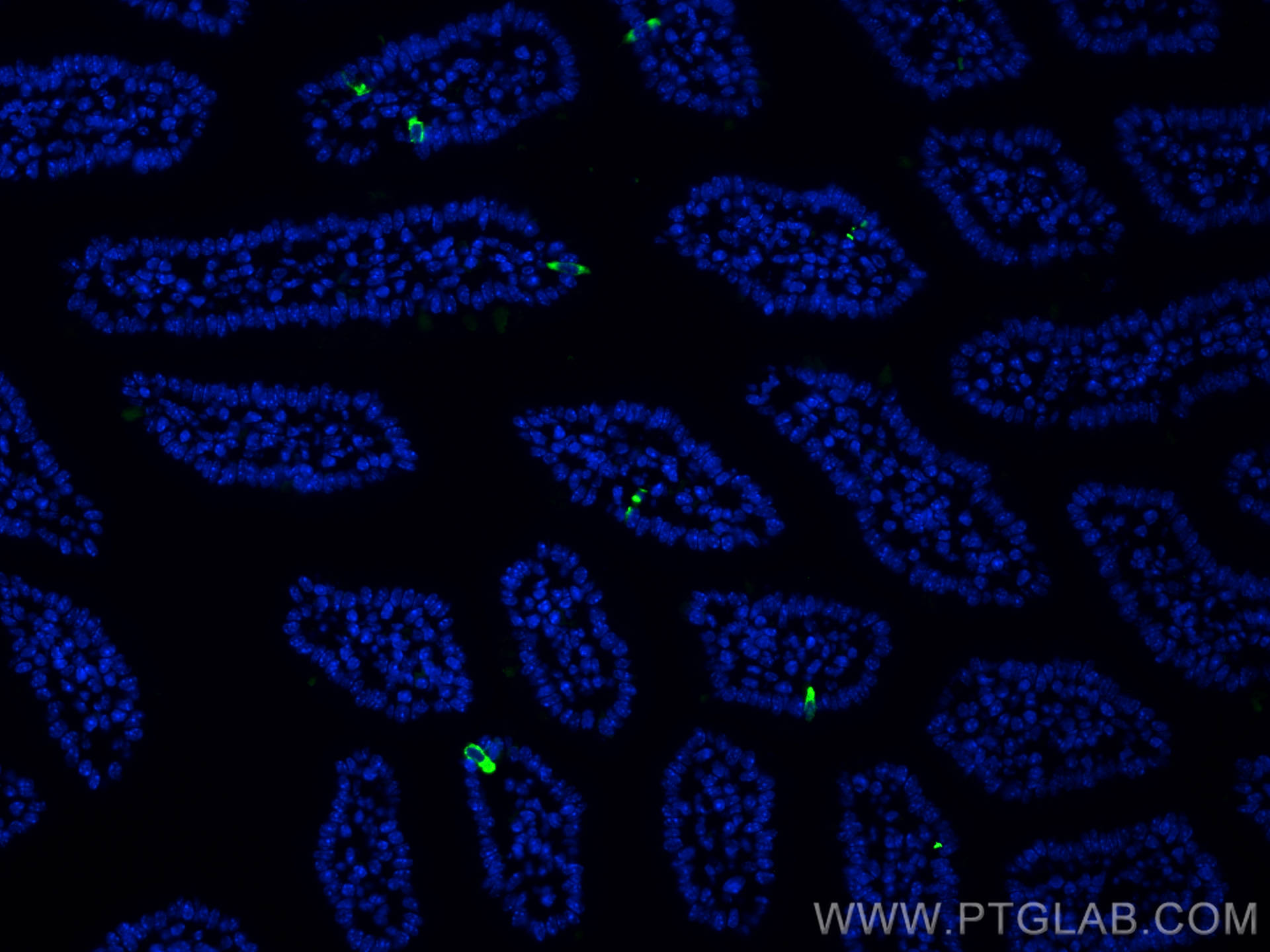 IF Staining of mouse small intestine using 23342-1-AP