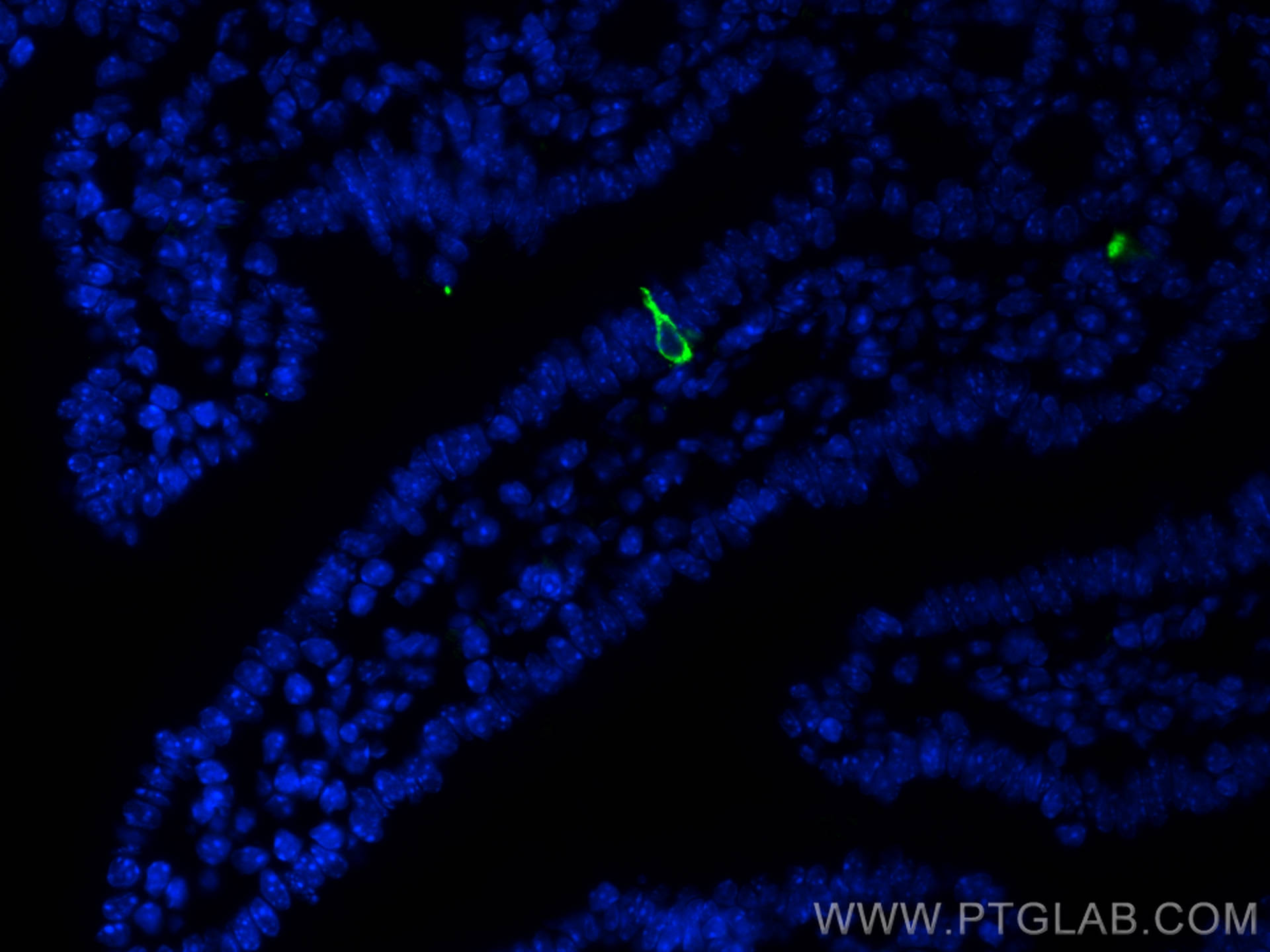 IF Staining of mouse small intestine using 23342-1-AP