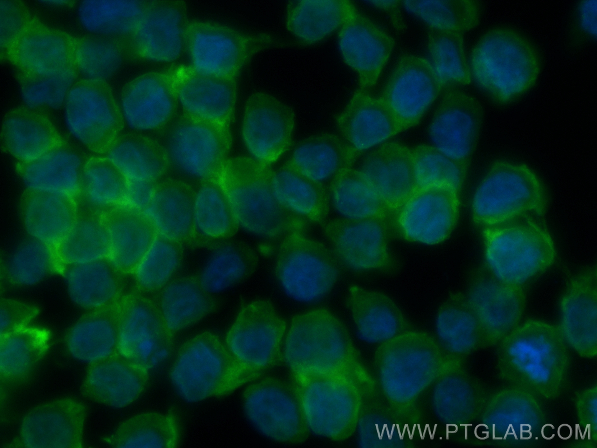 IF Staining of THP-1 using CL488-83685-4