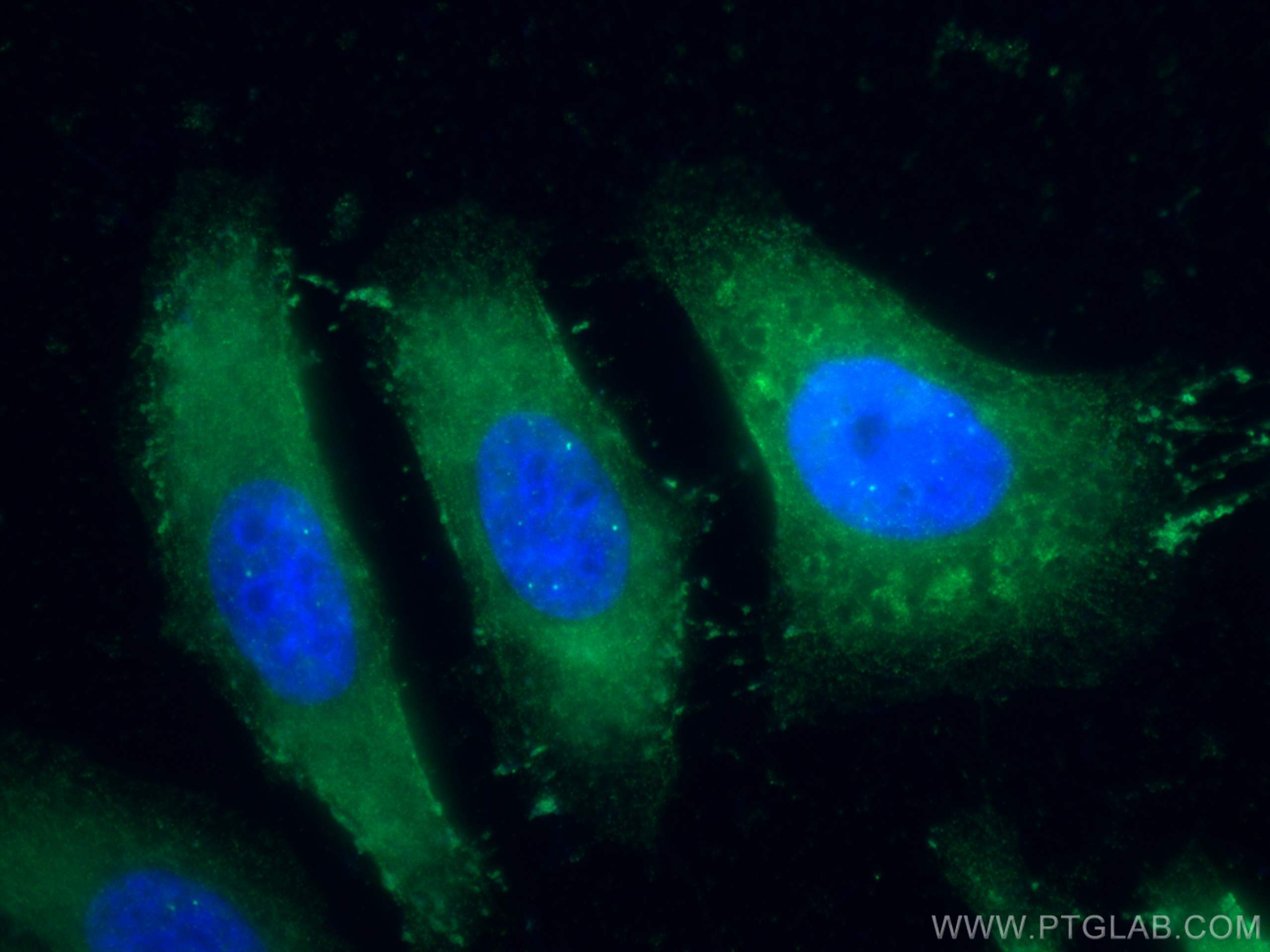 Choline Kinase Alpha