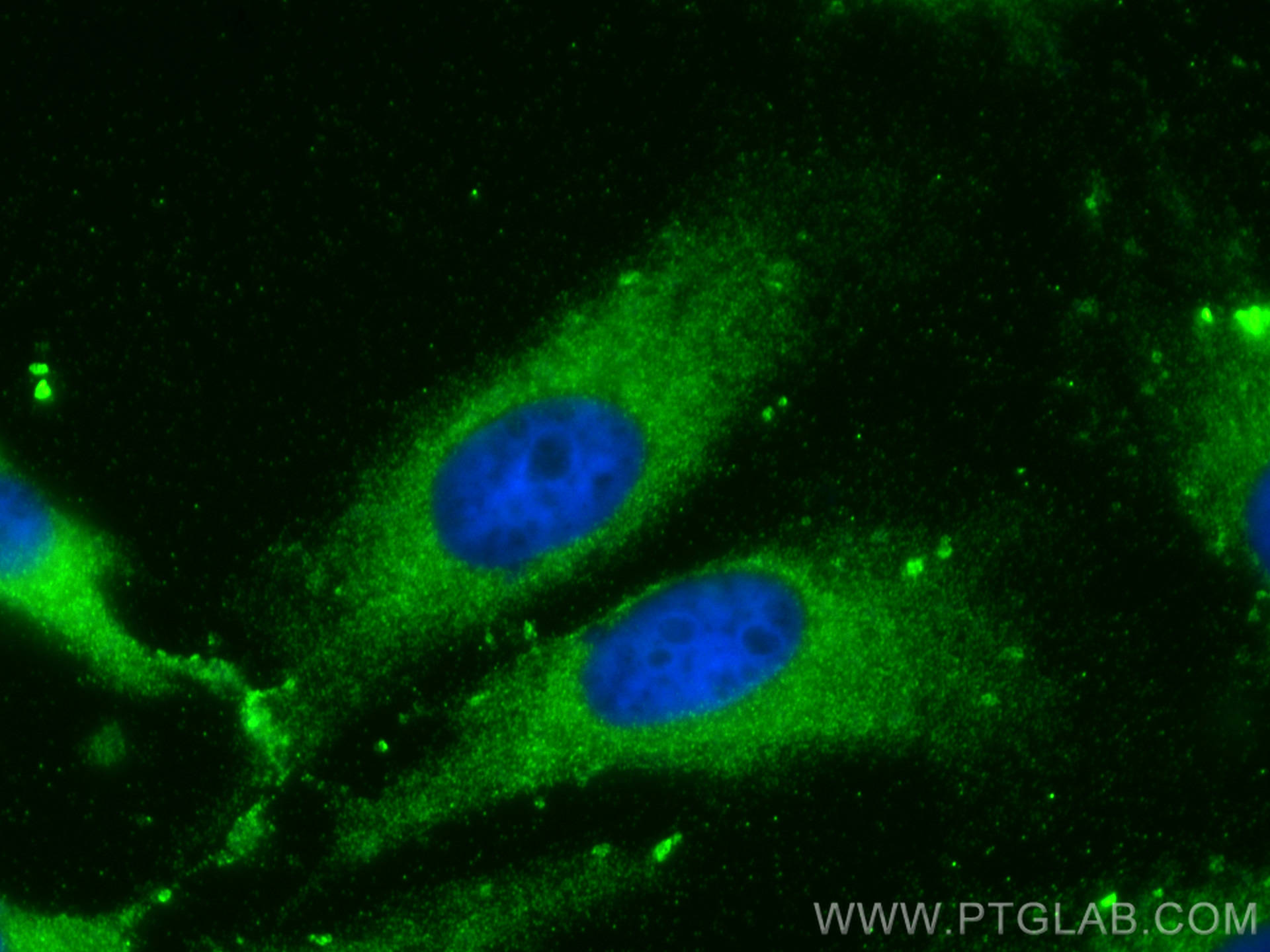 IF Staining of HeLa using 13520-1-AP