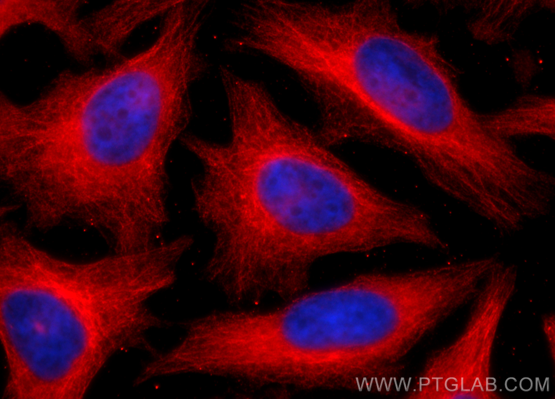 IF Staining of HeLa using 13520-1-AP