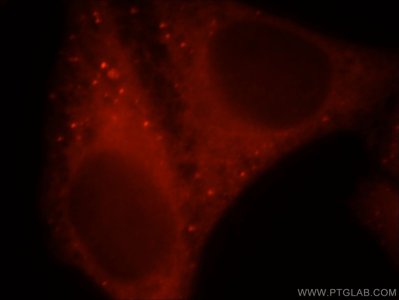 IF Staining of HepG2 using 19537-1-AP