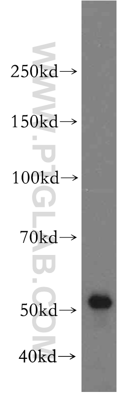 WB analysis of HepG2 using 19537-1-AP