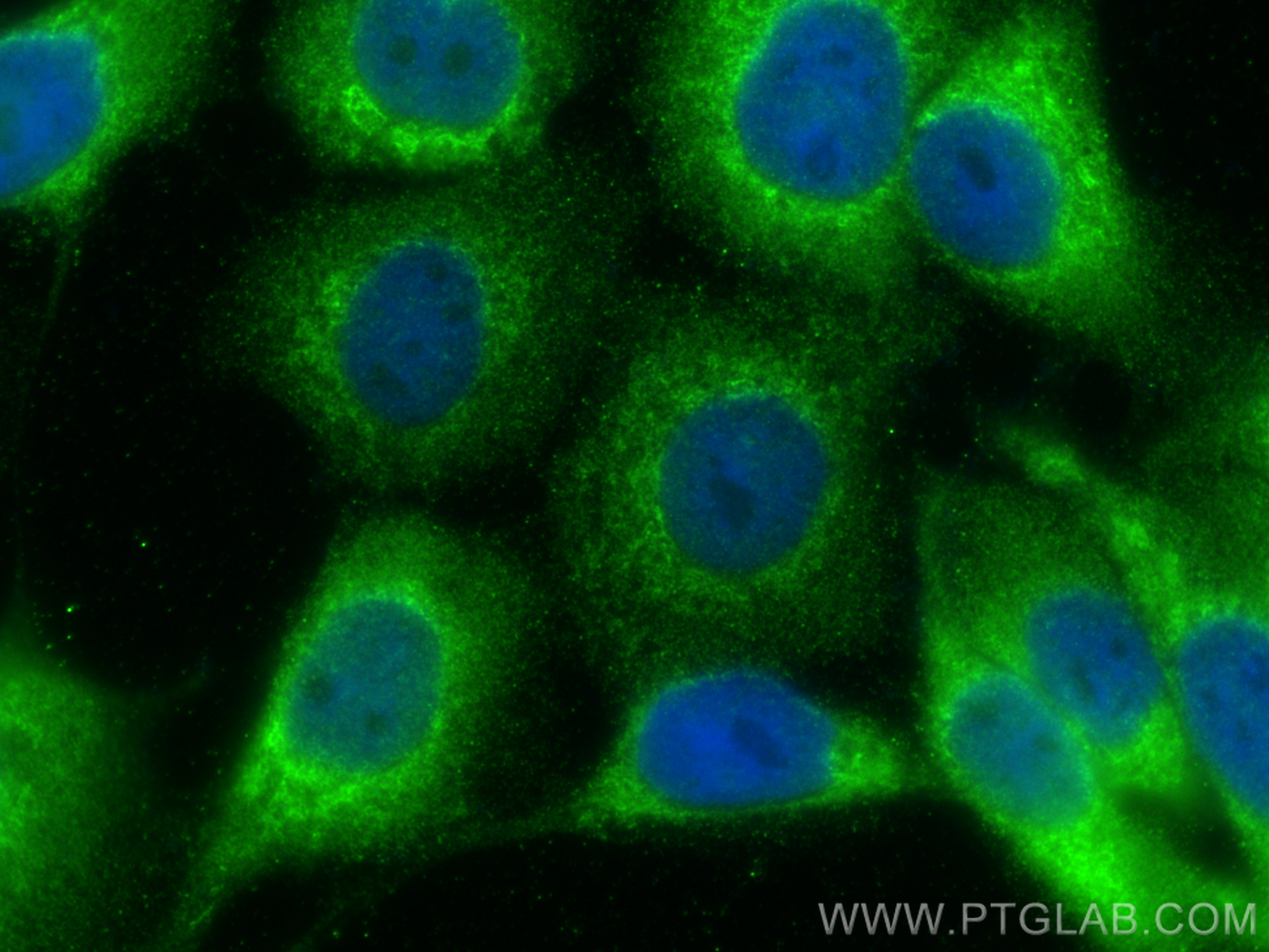 IF Staining of A431 using 26251-1-AP