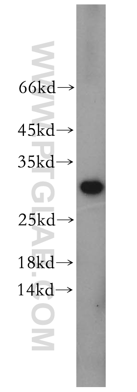 CHMP6 Polyclonal antibody