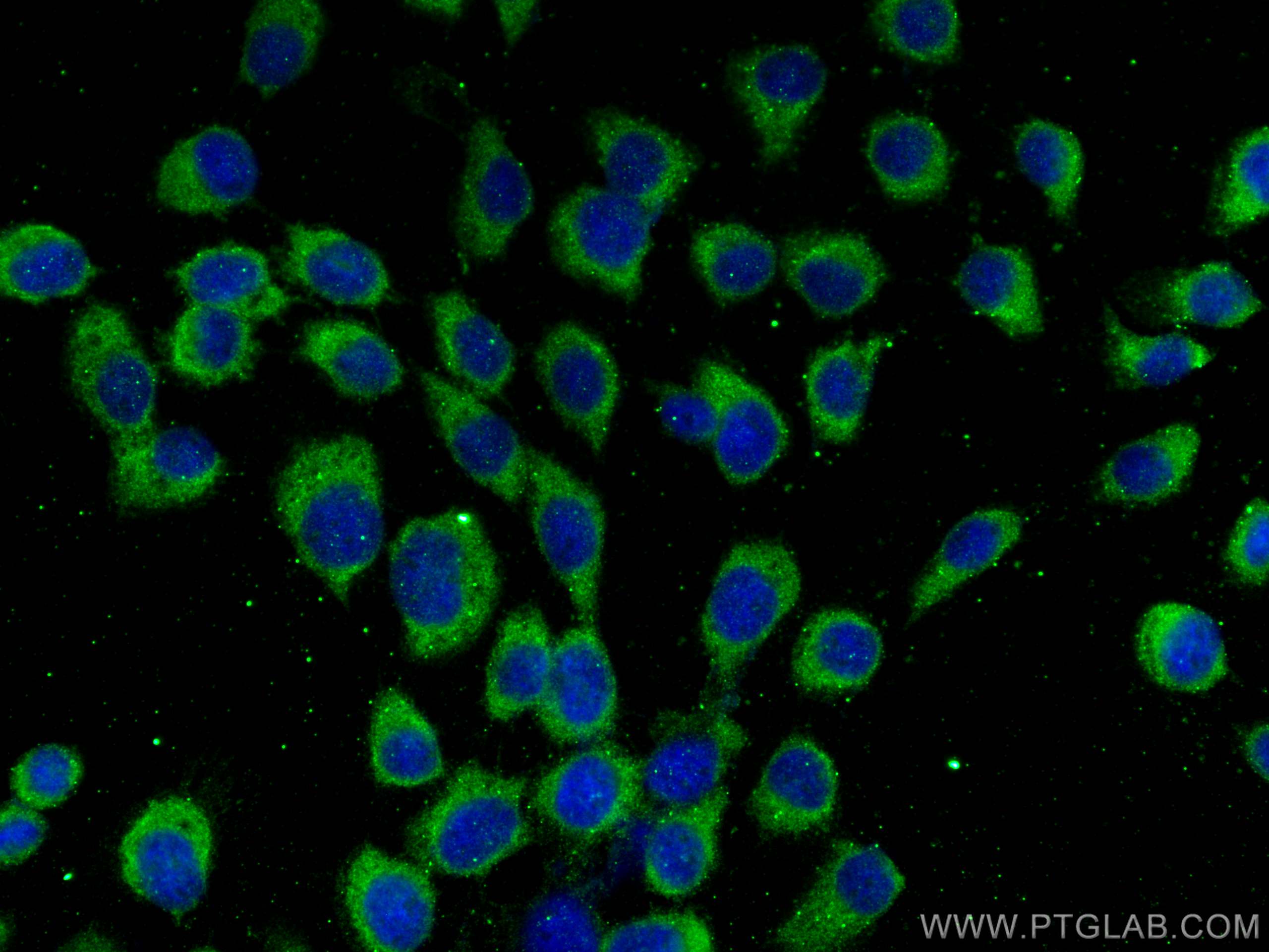 IF Staining of A431 using 68406-1-Ig (same clone as 68406-1-PBS)