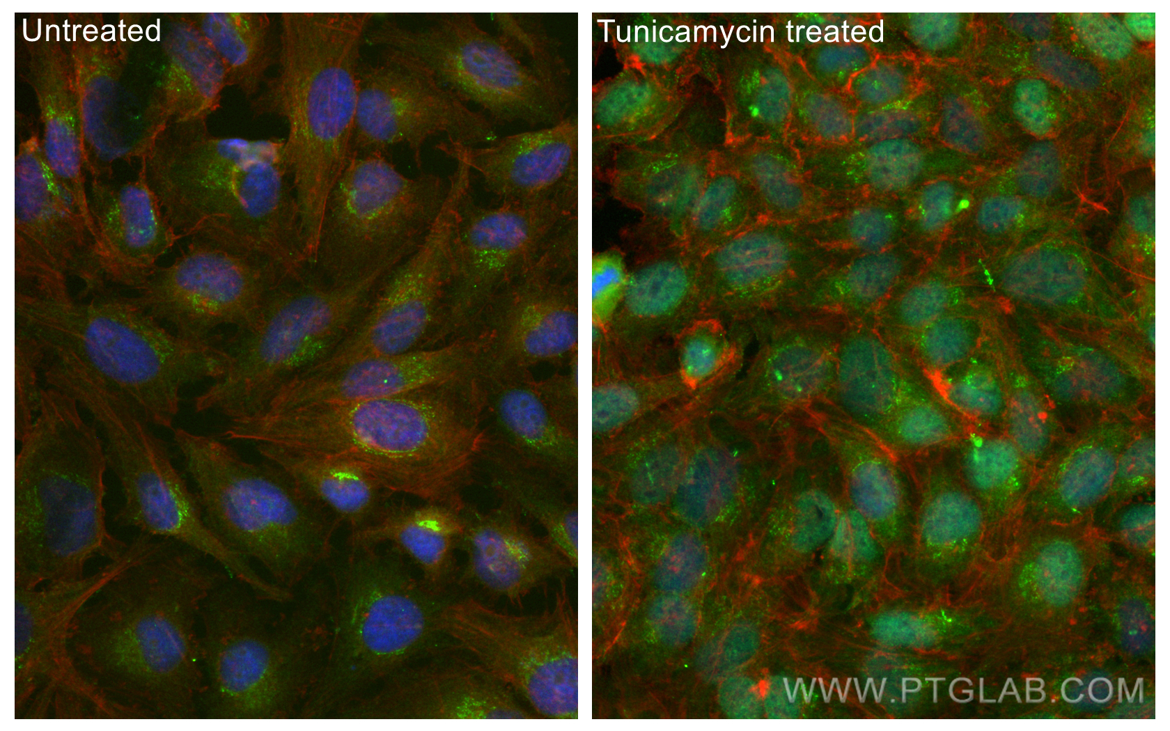 IF Staining of HeLa using CL488-15204