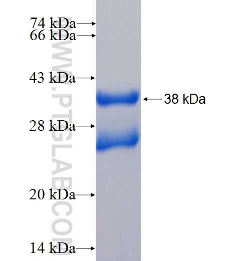 CHUK fusion protein Ag26573 SDS-PAGE