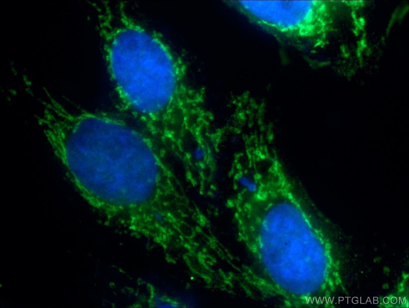 IF Staining of HepG2 using 10295-1-AP