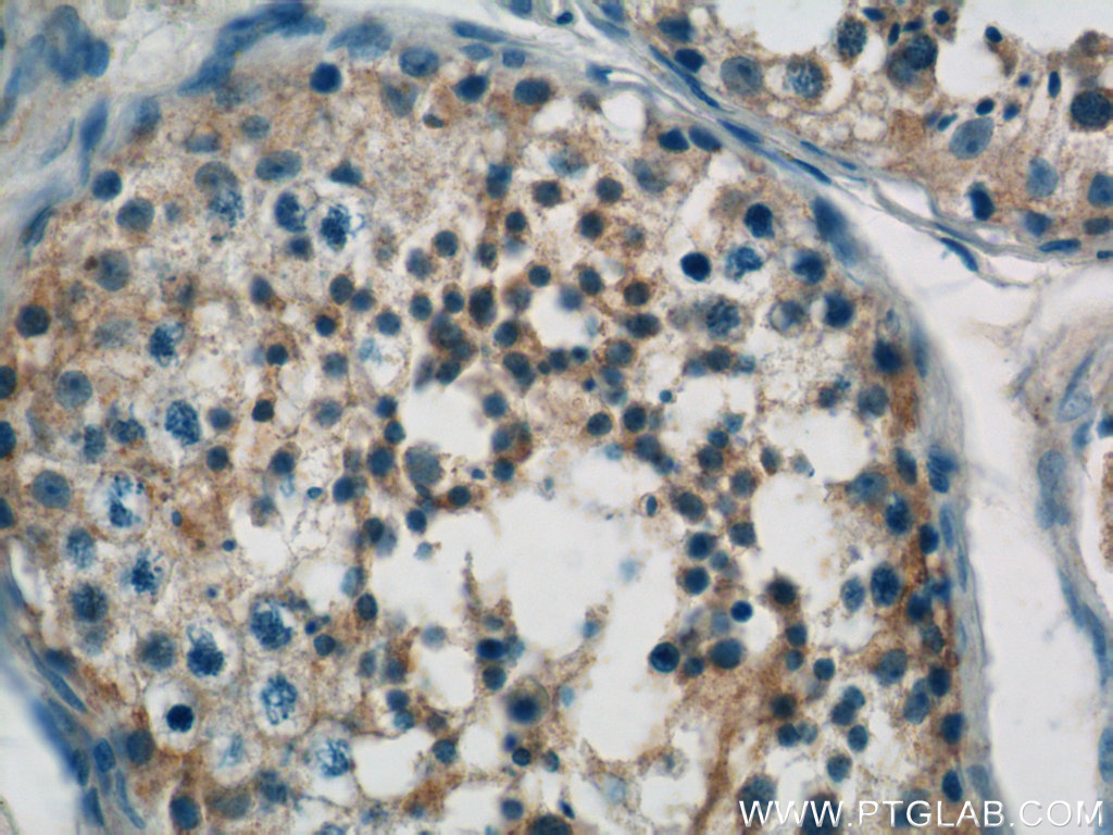 IHC staining of human testis using 10295-1-AP