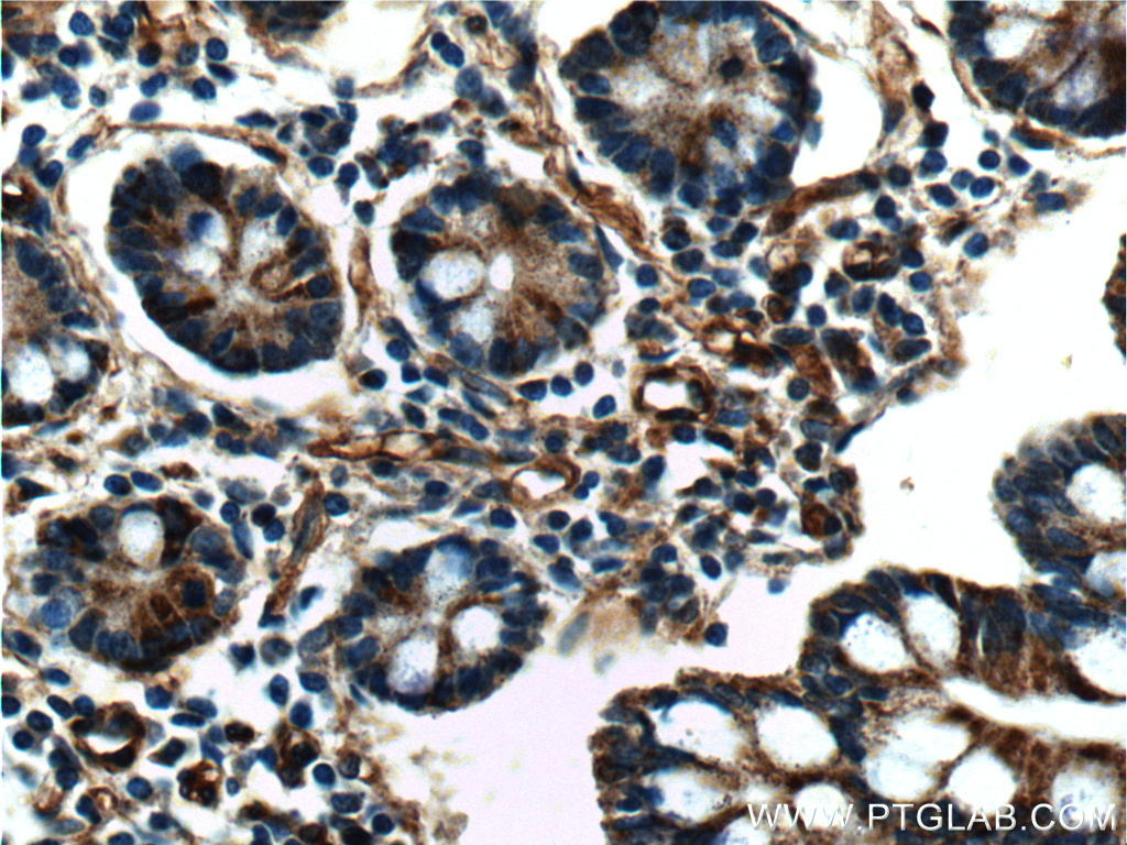 IHC staining of human small intestine using 10295-1-AP