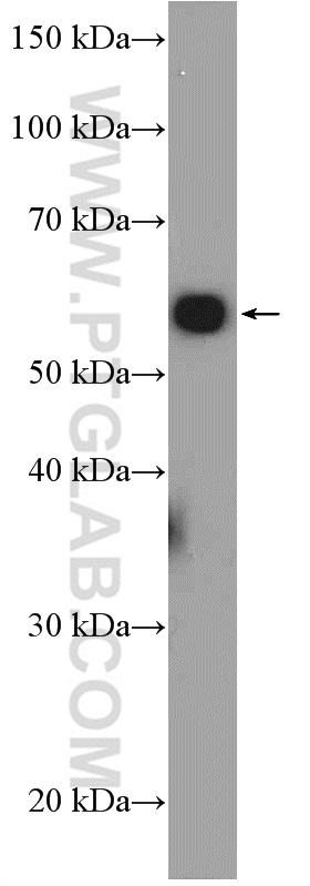 WB analysis of HepG2 using 10295-1-AP