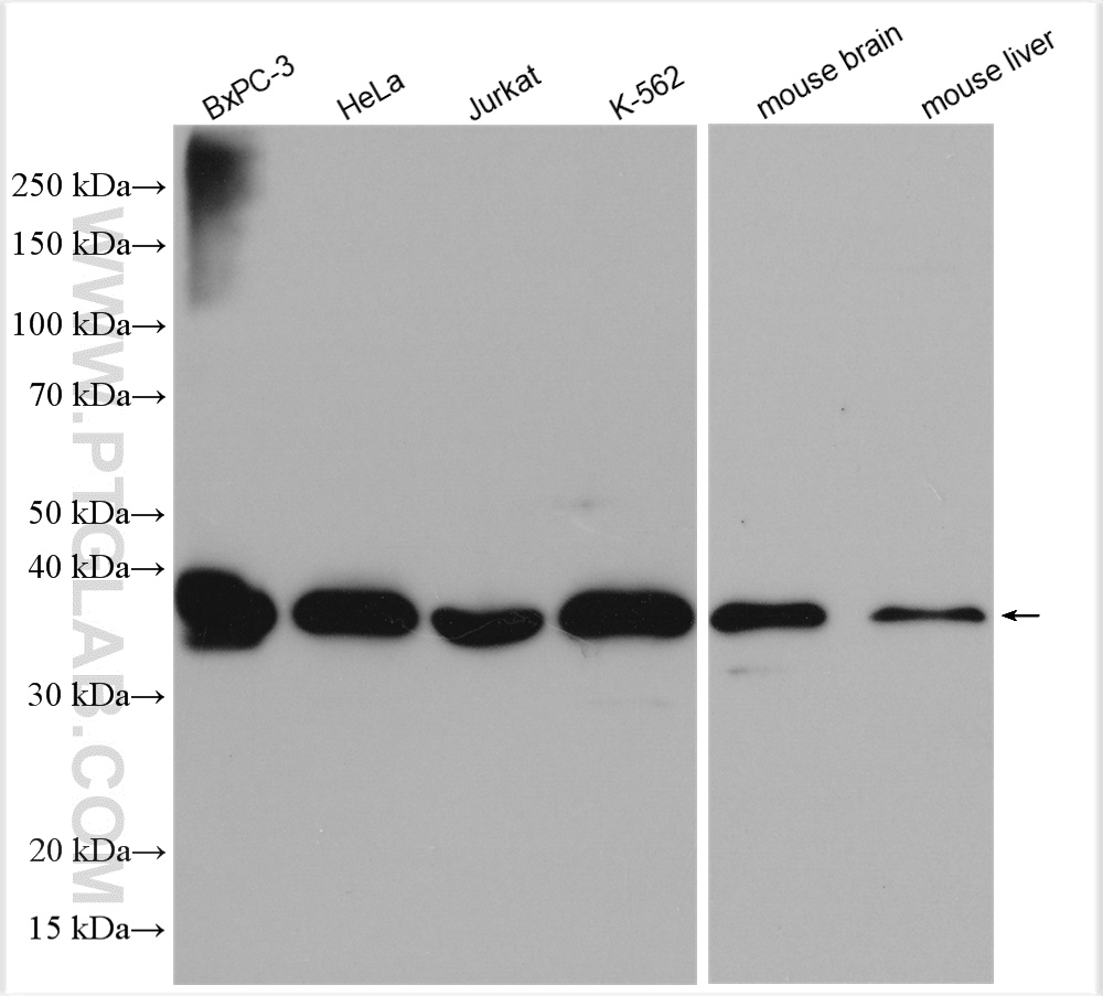 WB analysis using 12638-1-AP