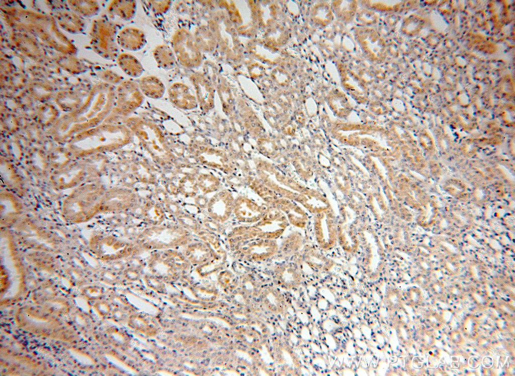 IHC staining of human kidney using 18840-1-AP