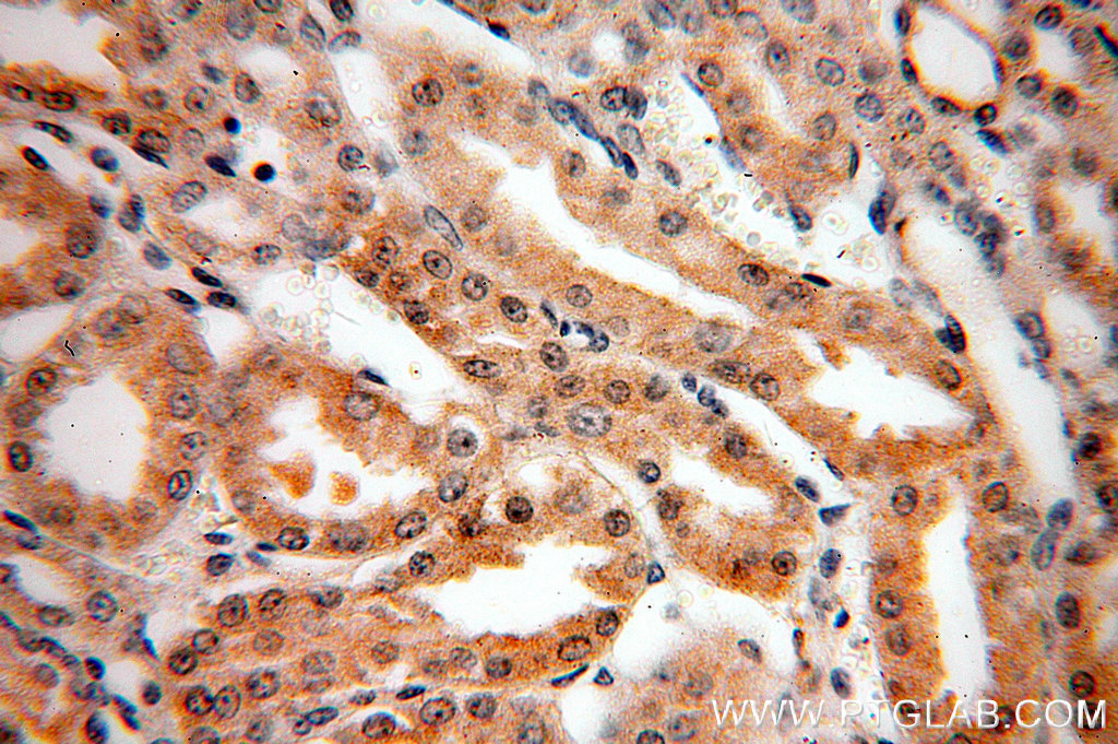 IHC staining of human kidney using 18840-1-AP