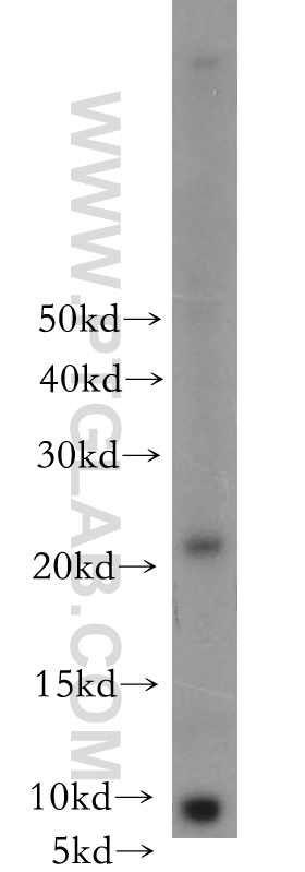 WB analysis of mouse lung using 18840-1-AP