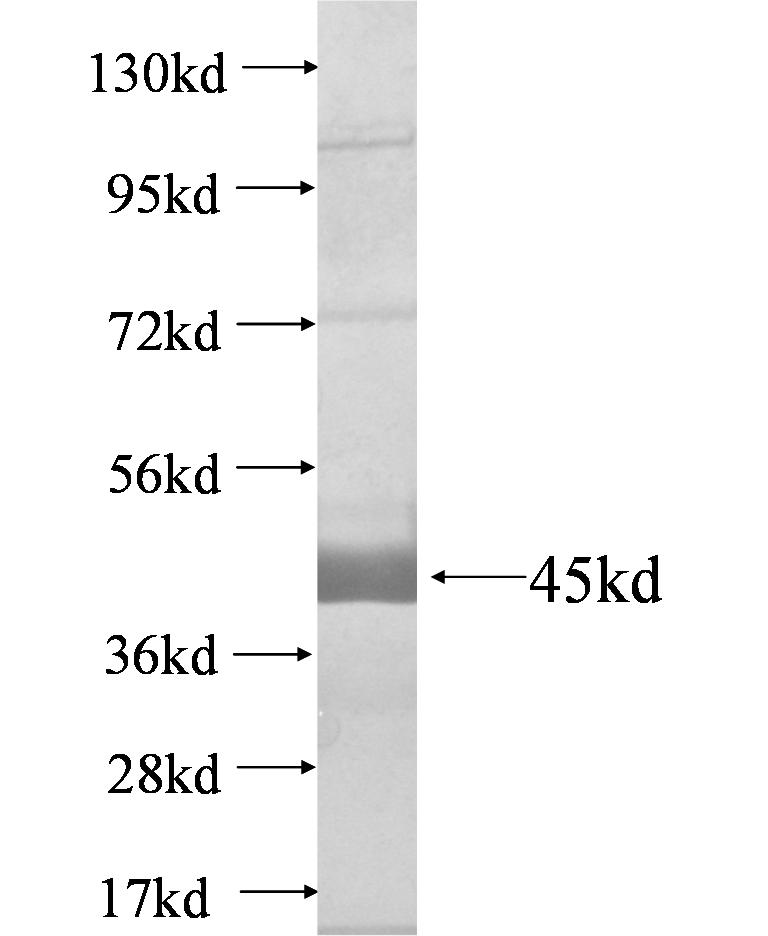 CILP fusion protein Ag4894 SDS-PAGE