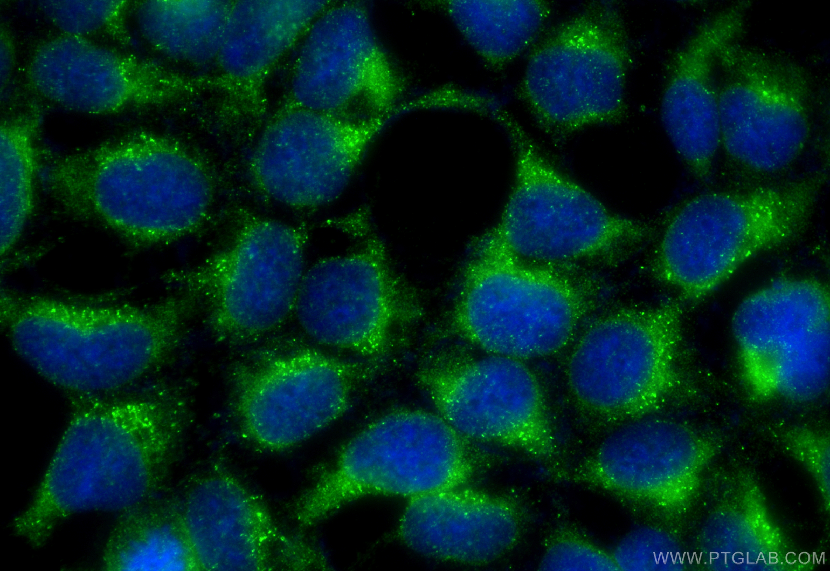 IF Staining of HEK-293 using 11813-1-AP