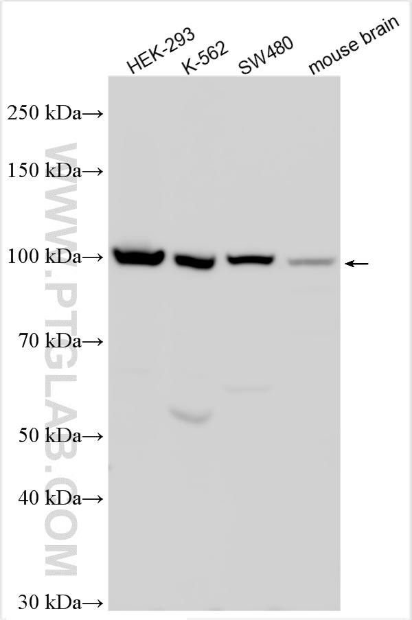 WB analysis using 11813-1-AP