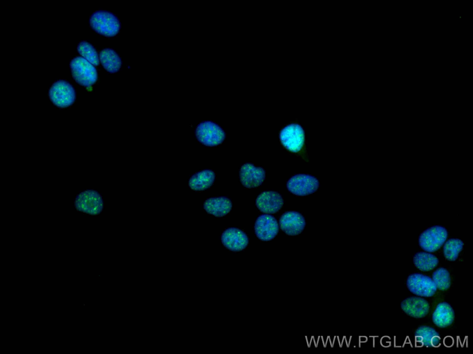 IF Staining of MCF-7 using 15798-1-AP