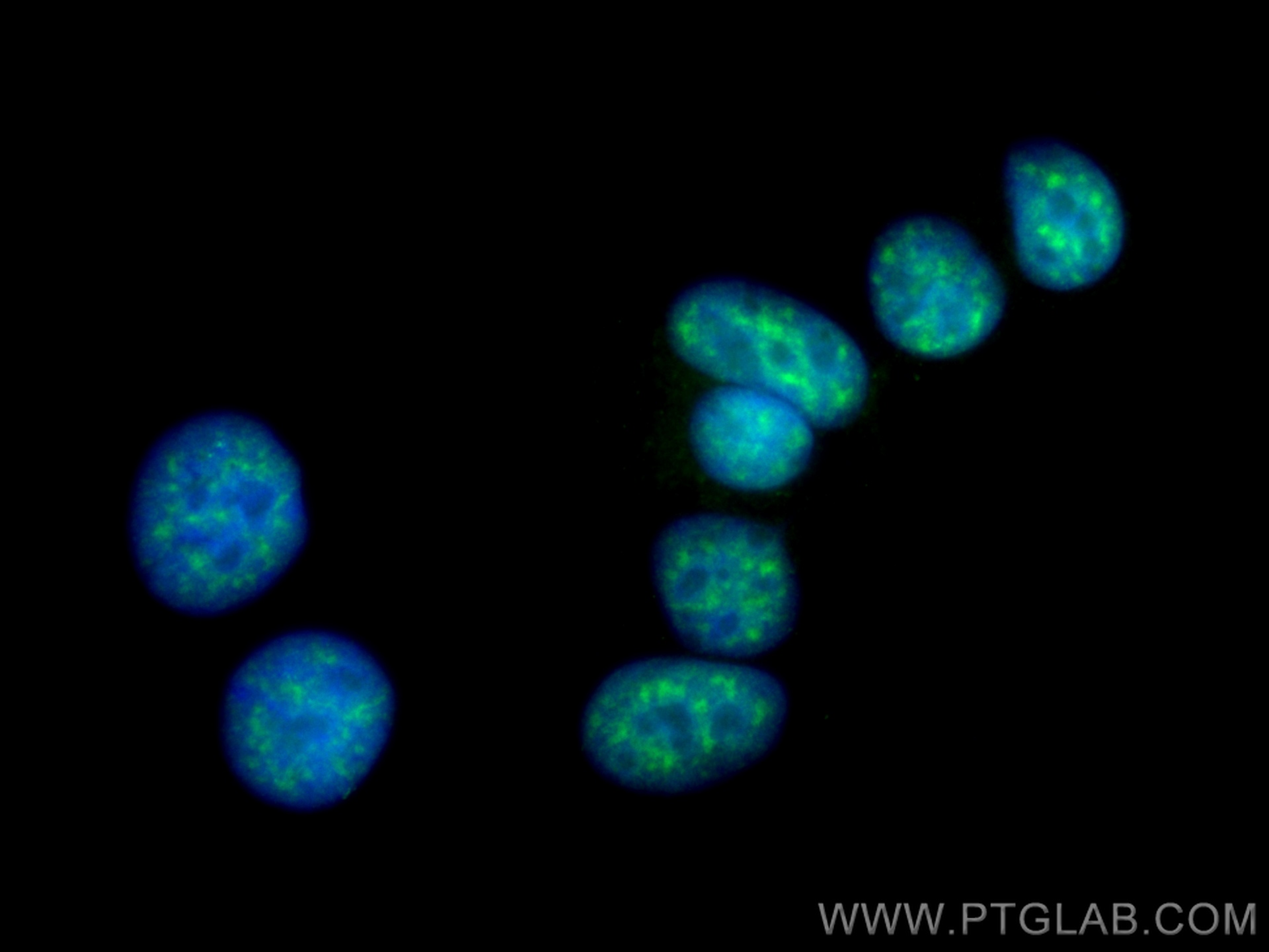 IF Staining of MCF-7 using 15798-1-AP