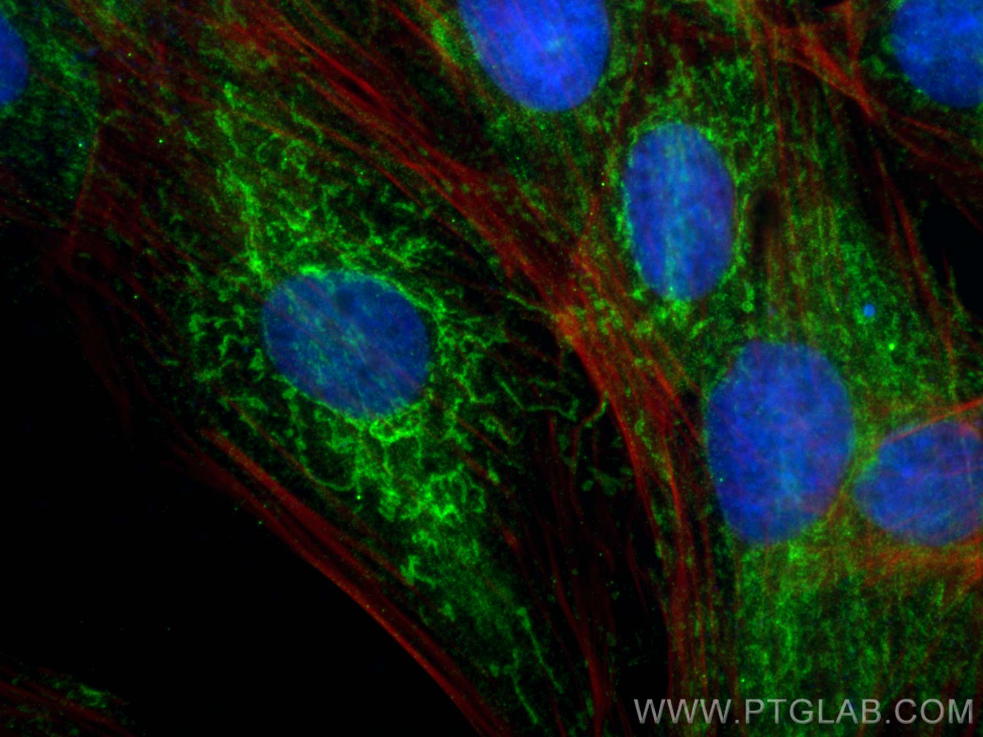 IF Staining of H9C2 using 68030-1-Ig (same clone as 68030-1-PBS)