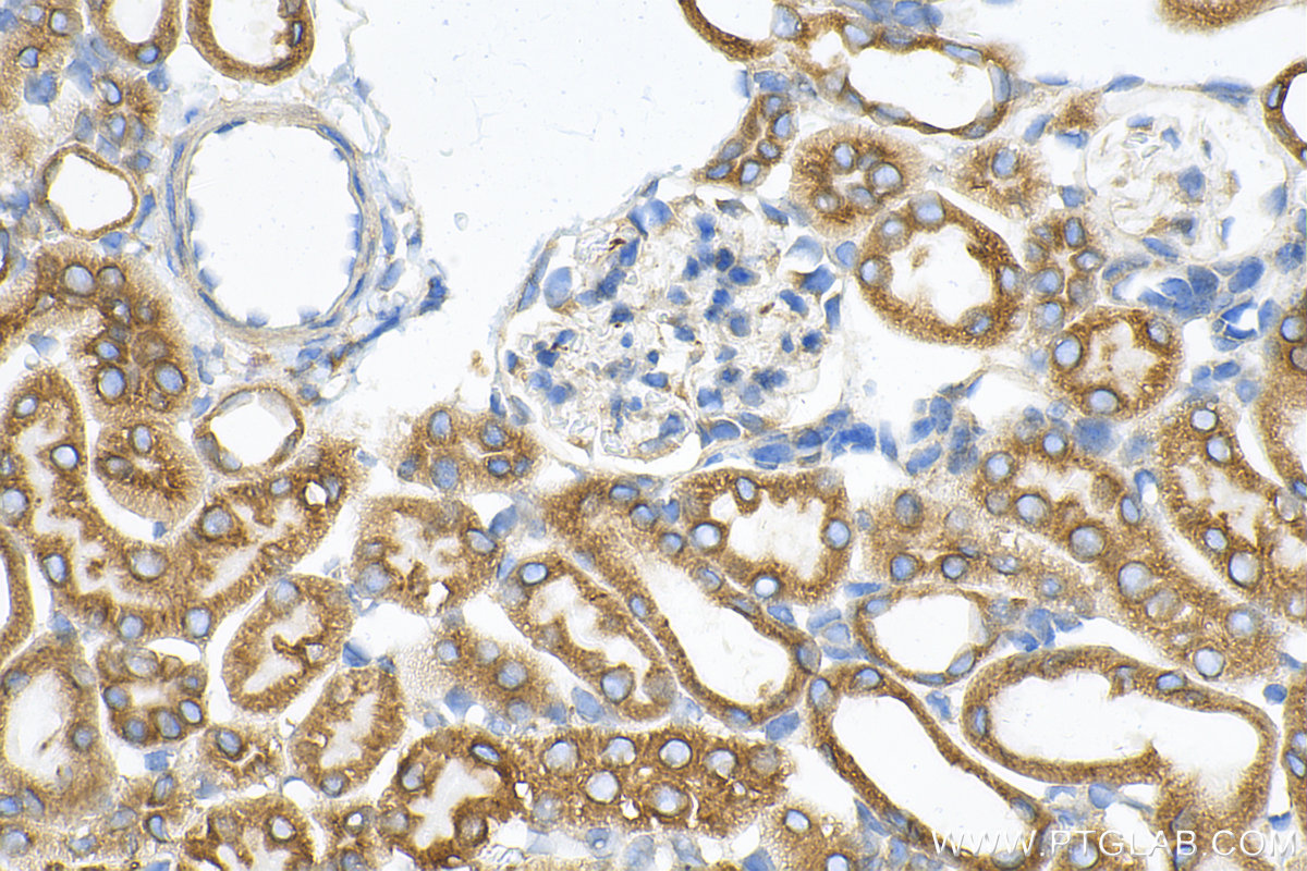 IHC staining of mouse kidney using 82802-10-RR