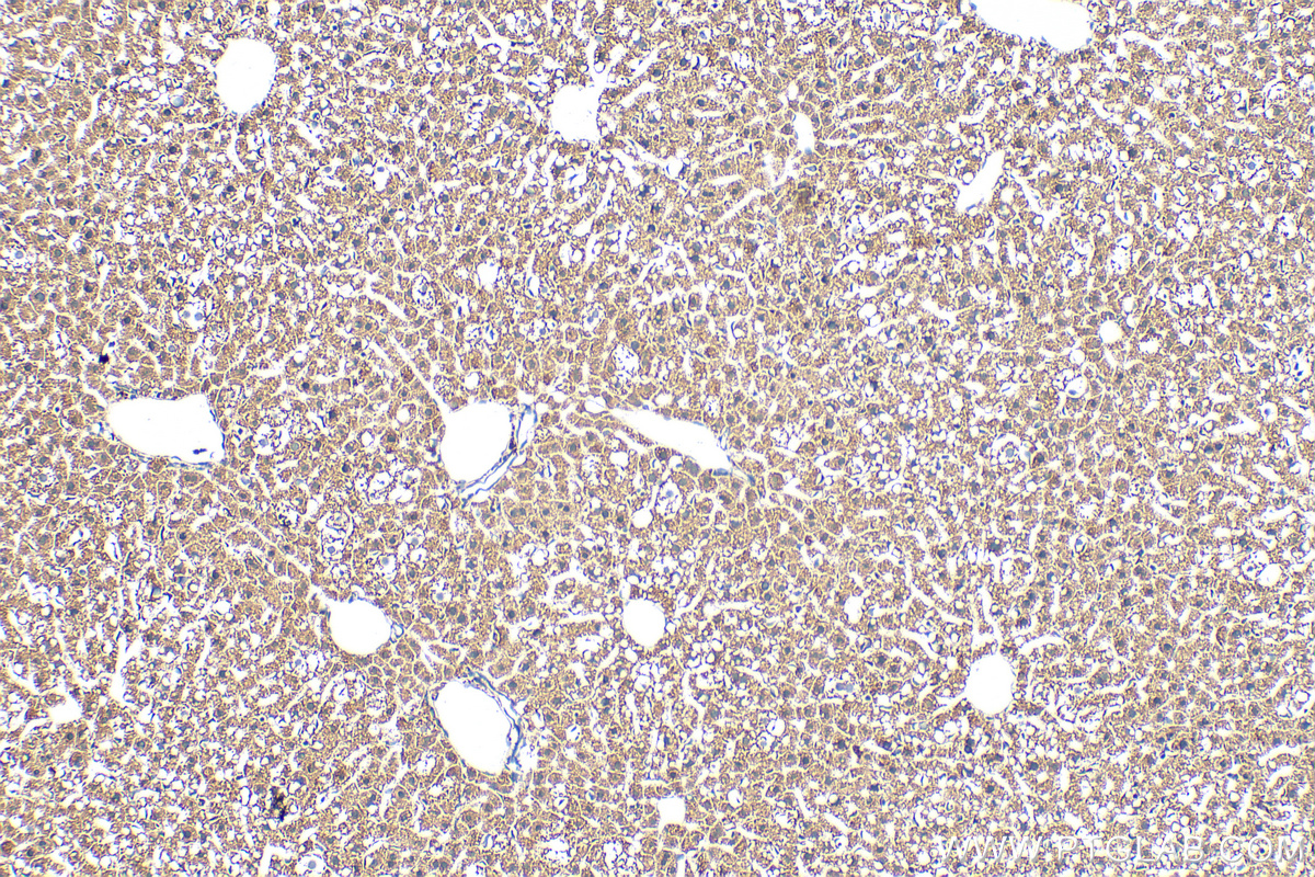 IHC staining of mouse liver using 30480-1-AP