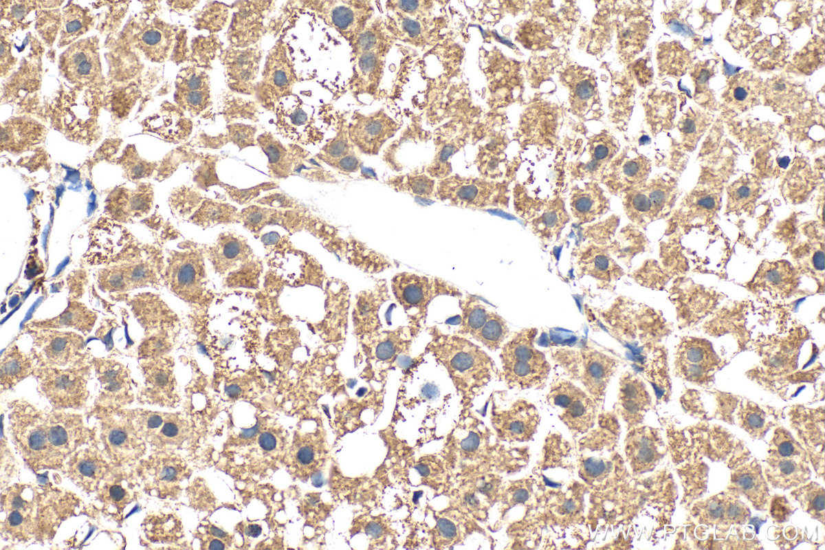 IHC staining of mouse liver using 30480-1-AP