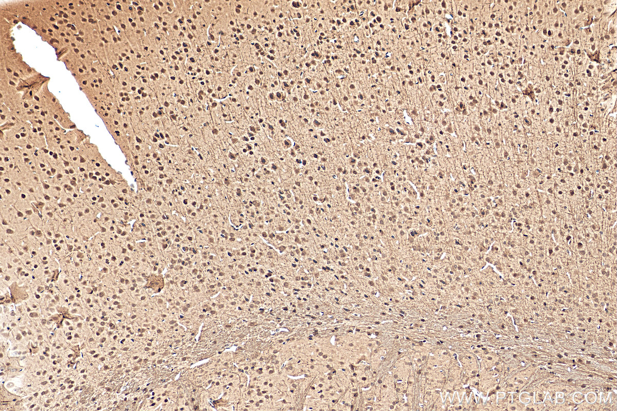 IHC staining of mouse brain using 15021-1-AP