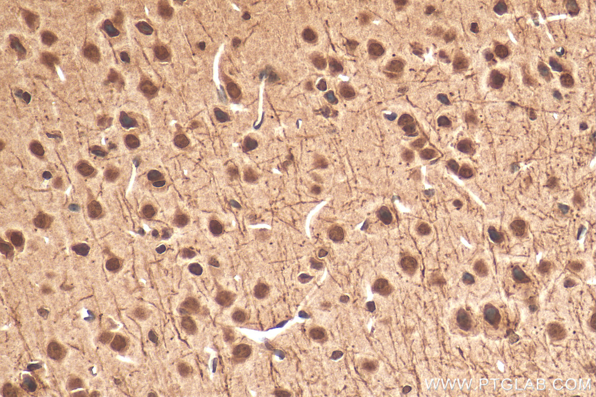 IHC staining of mouse brain using 15021-1-AP