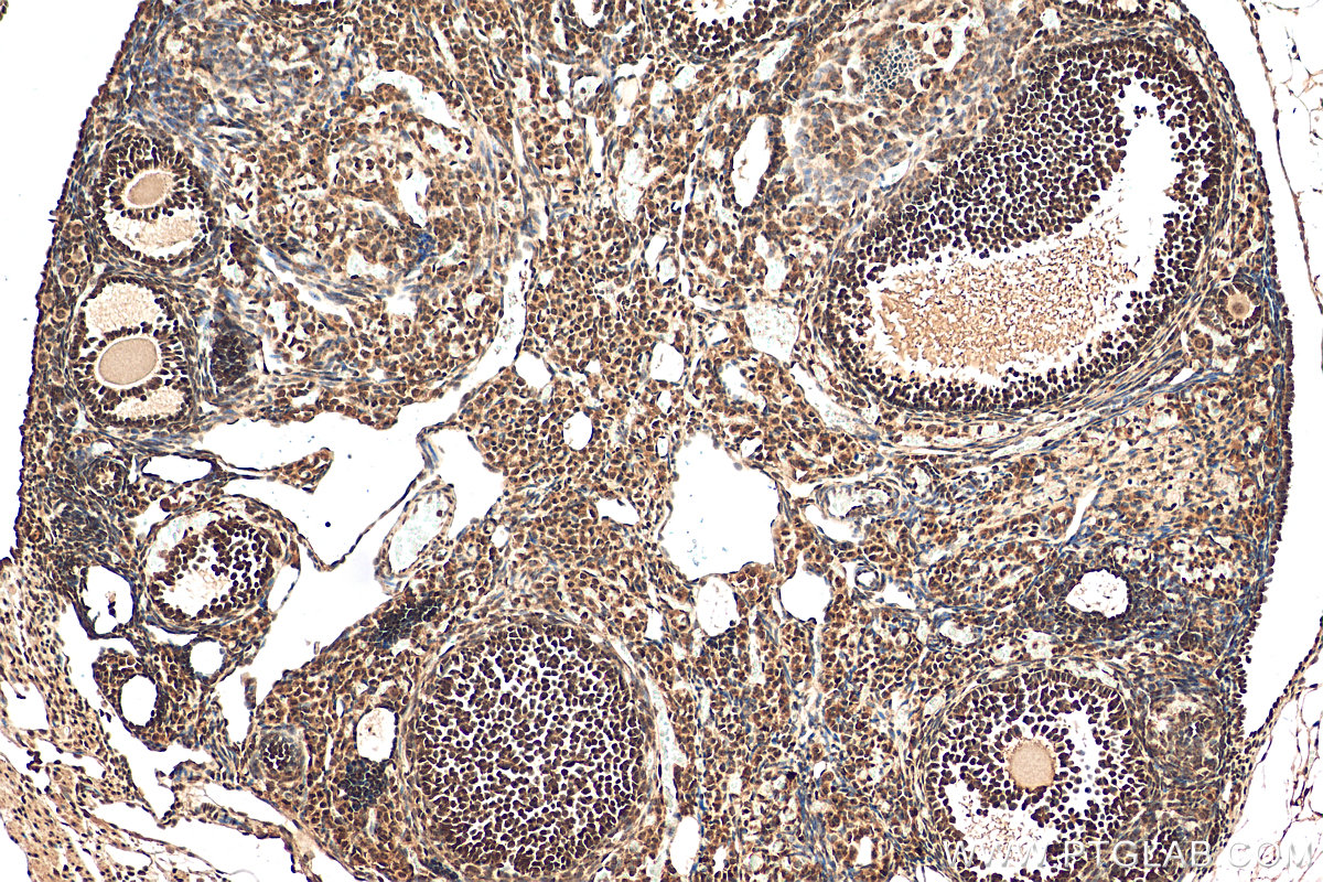 IHC staining of mouse ovary using 15021-1-AP