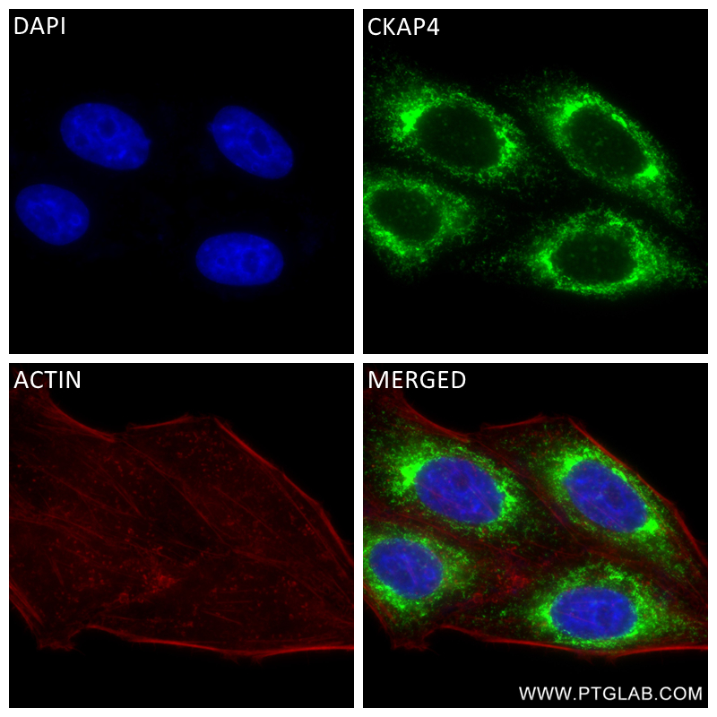 IF Staining of HepG2 using 84485-4-RR (same clone as 84485-4-PBS)